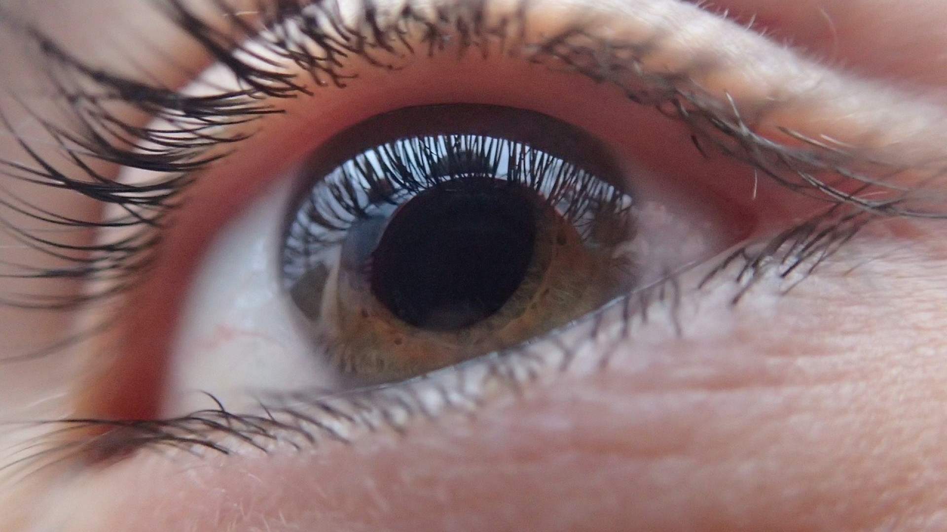Traitement de la cataracte : optez pour l'implant monofocal